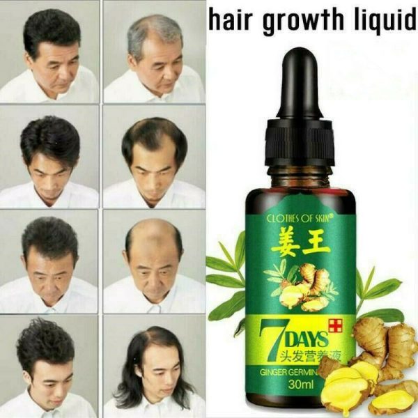 7 Day Ginger Germinal Oil Hair Nutrient Solution Hair Growth Essence Liquid Fast Natural Hair Loss Treatment Hair Care (30ml)